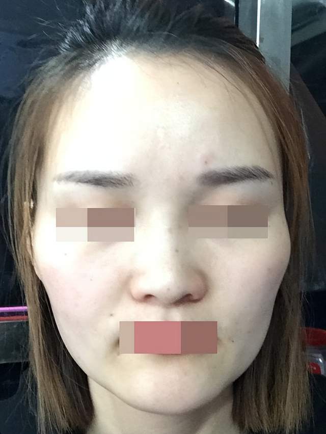 波折不流畅的面部轮廓应该如何改善 - 好大夫在线