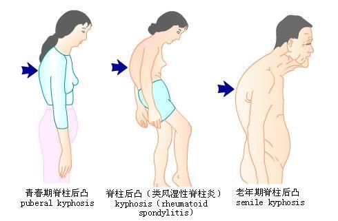 圖文圖片