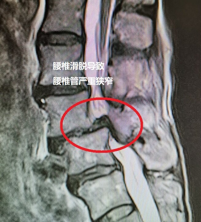 圖文圖片