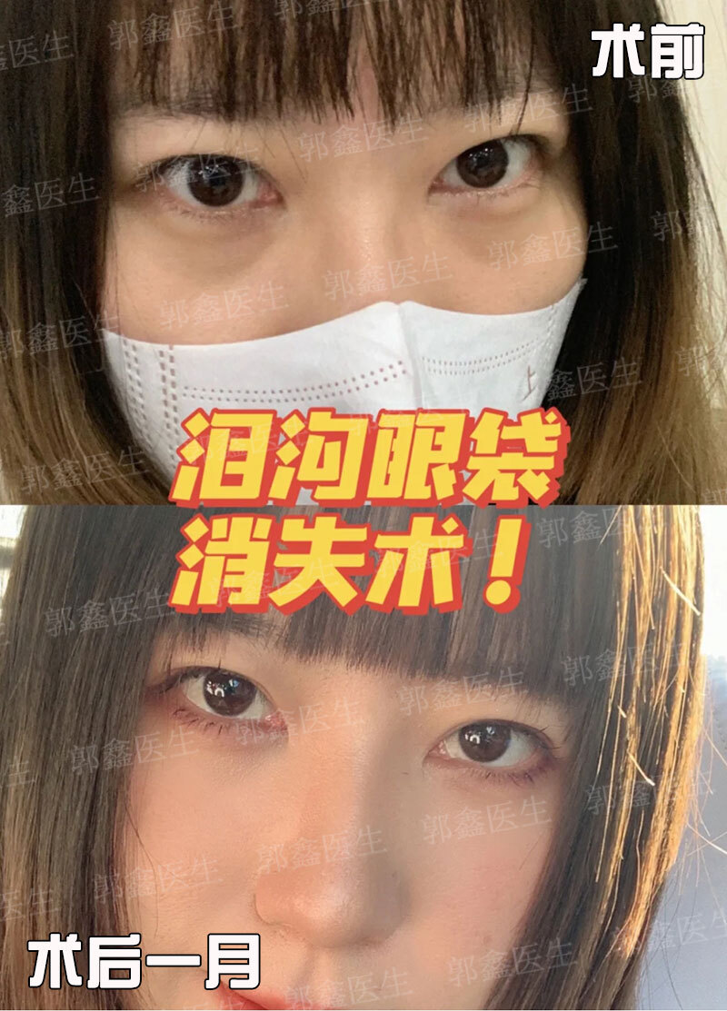 圖文圖片