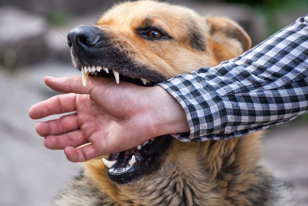 iStock-801996040-Dog-Bites.jpg