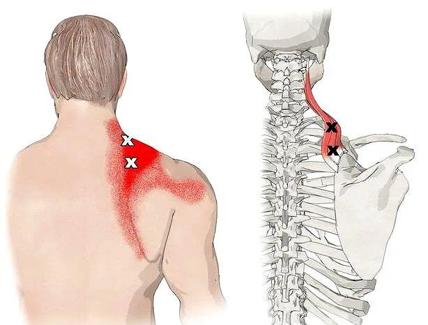 引起肩关节痛的常见疾病