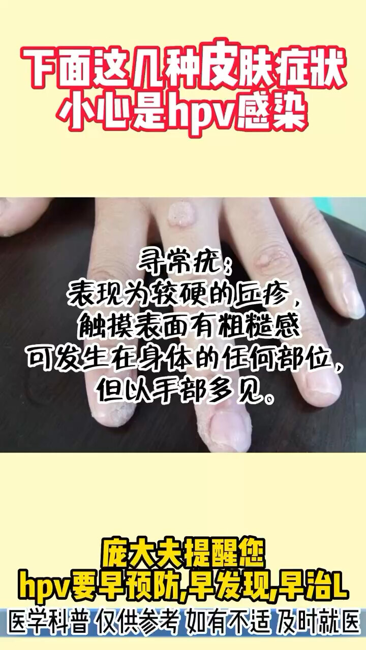 默认图片