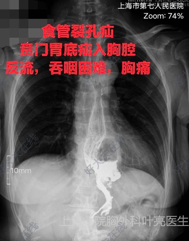 圖文圖片