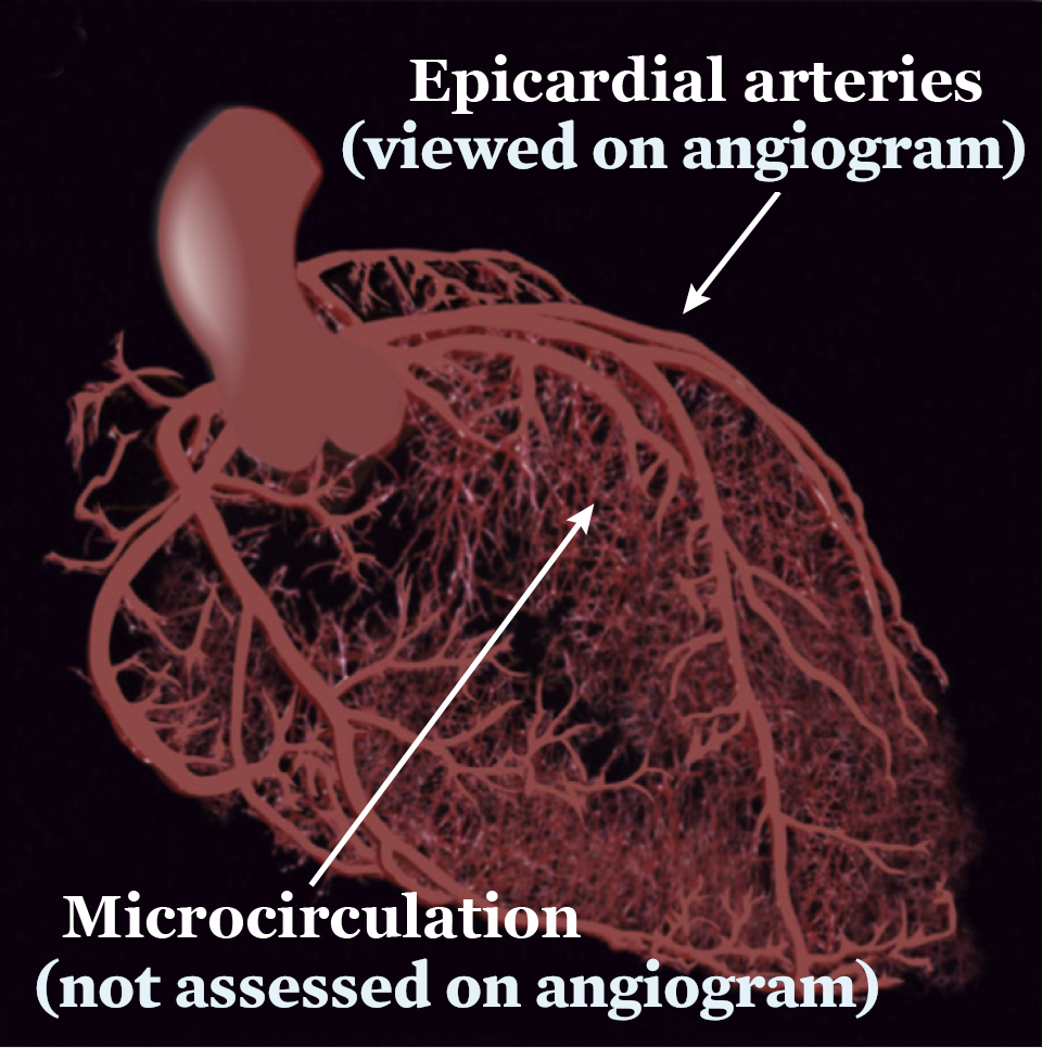冠状动脉微血管功能障碍de新视界_冠心病_冠心病介绍 - 好大夫在线