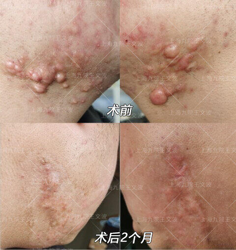 圖文圖片