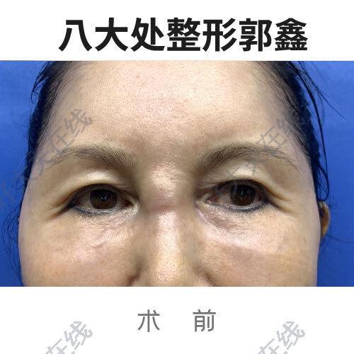 圖文圖片