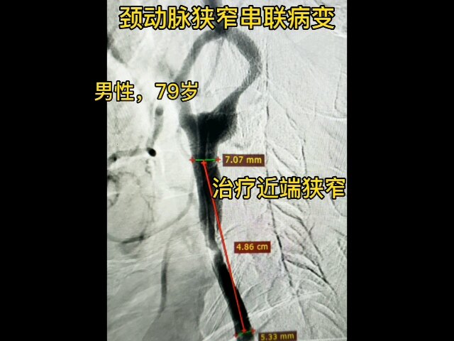 默认图片