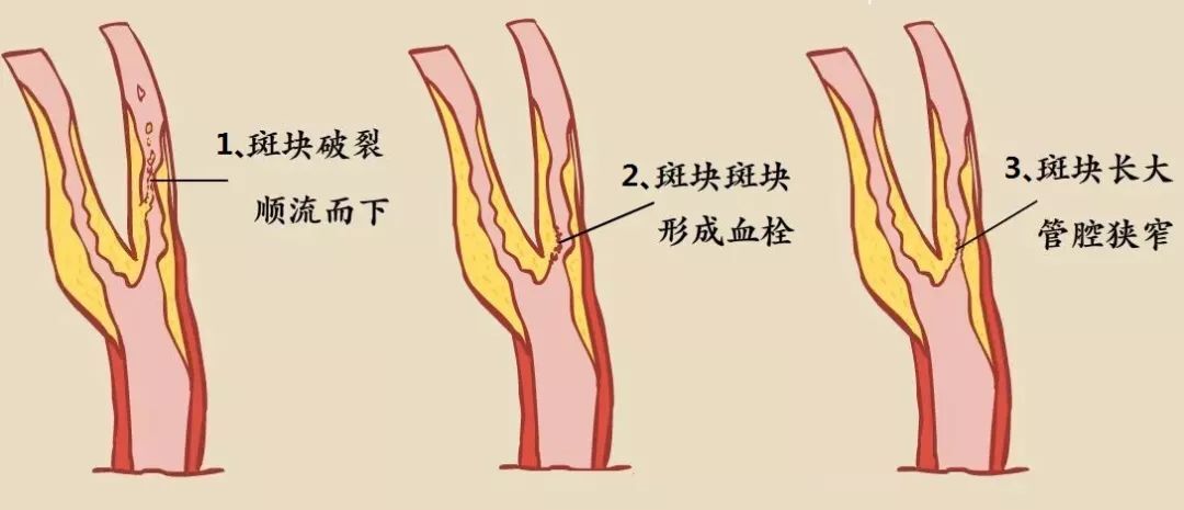 圖文圖片