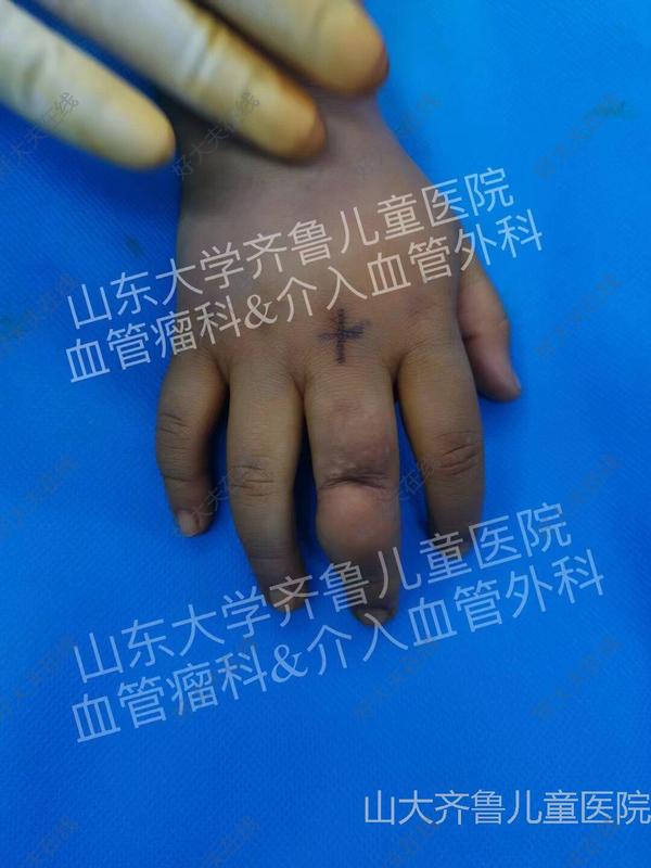 圖文圖片