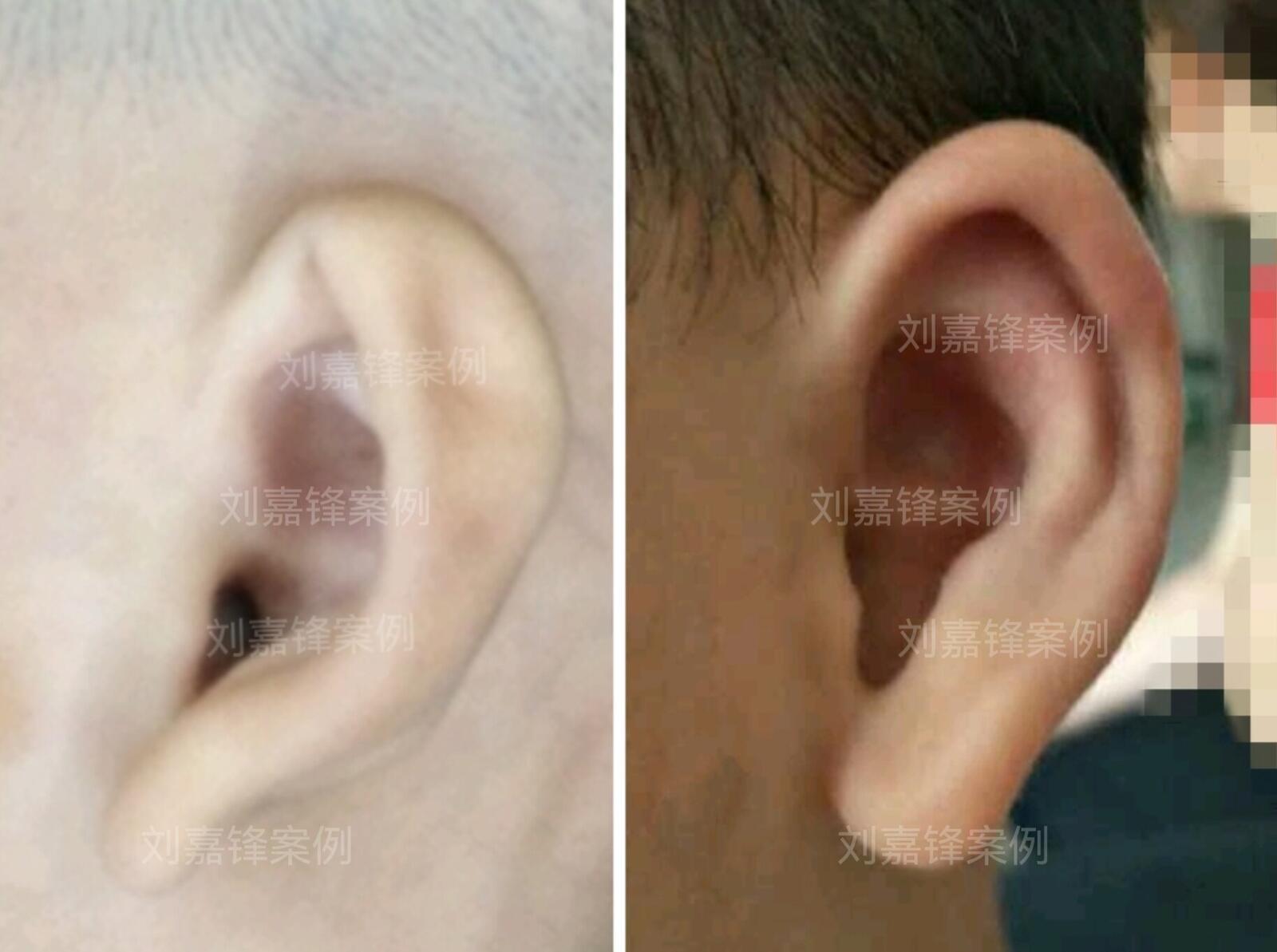 圖文圖片