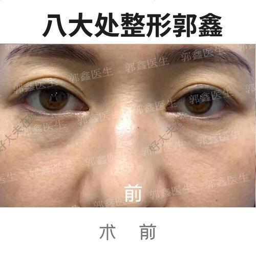 圖文圖片