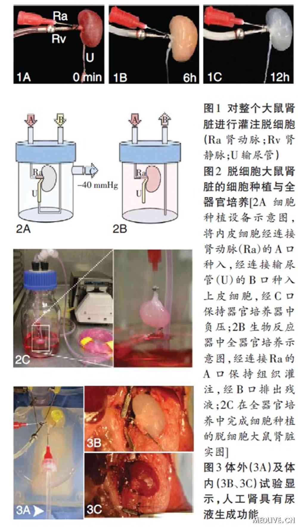 美国的人工肾进入中国图片