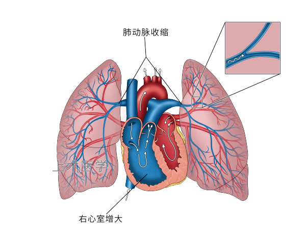 肺脏血管分布图图片