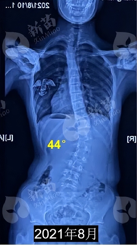 圖文圖片