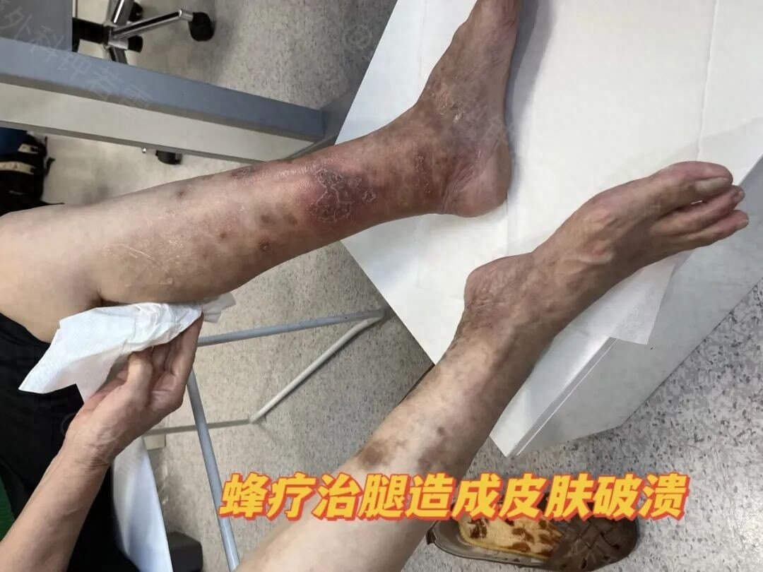 圖文圖片