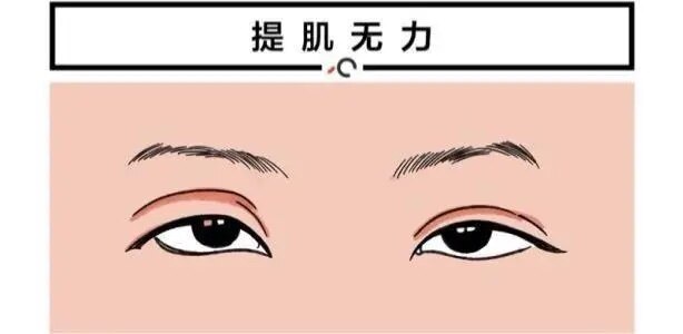 圖文圖片