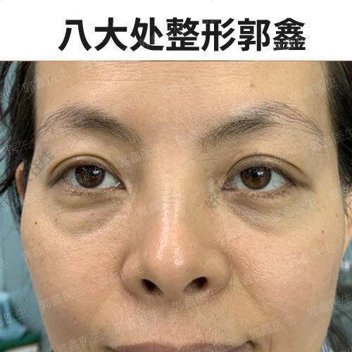 圖文圖片