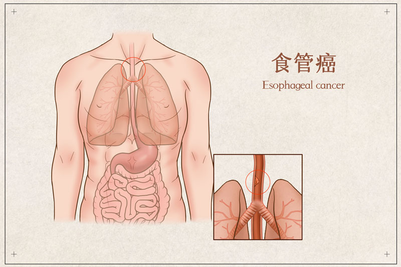 圖文圖片