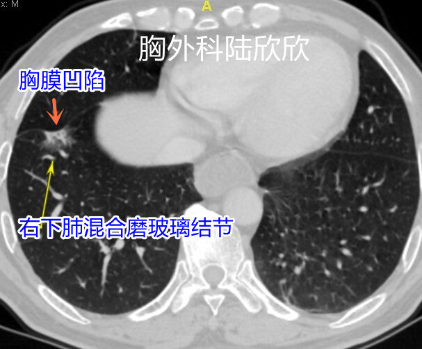 右下薄层185水印.jpg