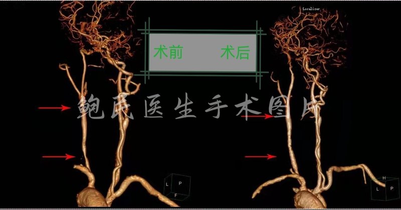 圖文圖片