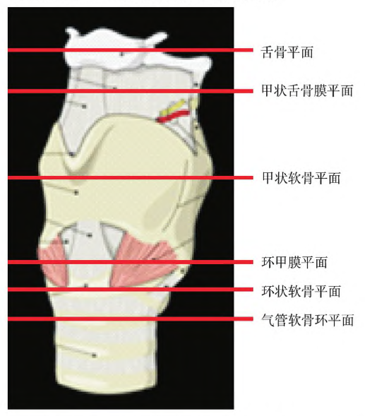 如舌體,舌骨,會厭,聲帶,甲狀軟骨,環狀軟骨,環甲膜及氣管軟骨等