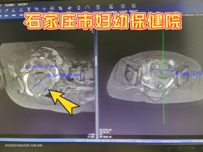 圖文圖片