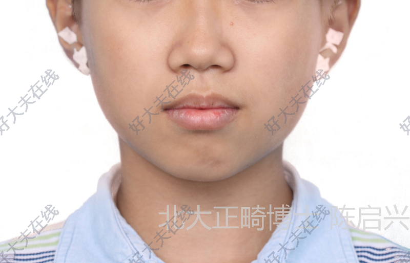 圖文圖片