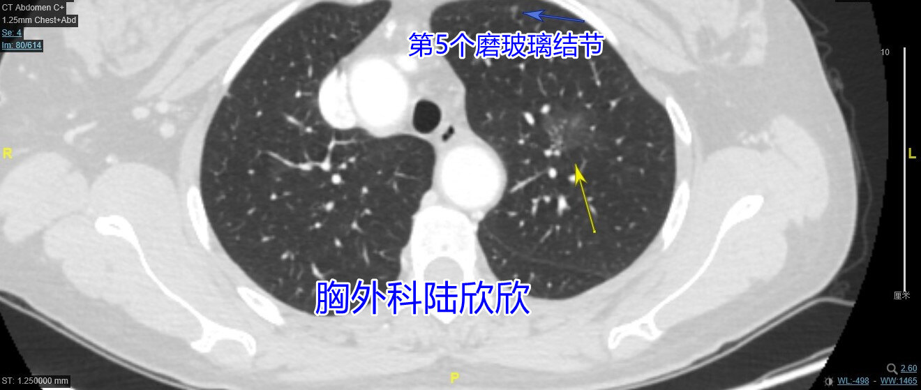 左上4薄层80副本.jpg