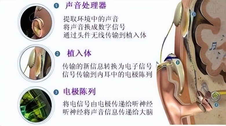 什么是进一步交流 1IYBAGWaTM2AV_VPAAHvunt71pc543.png?_ms_=c303