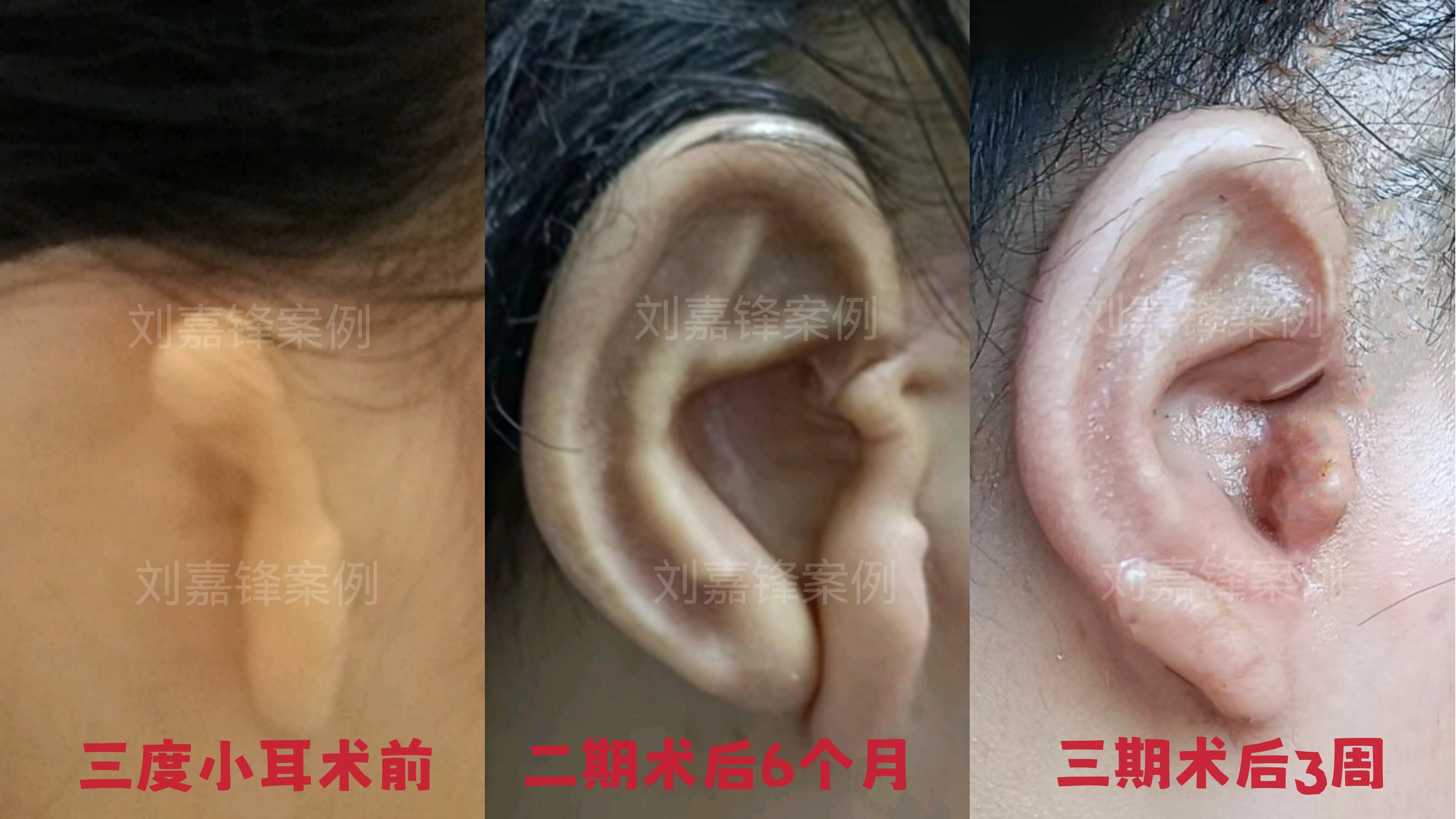 圖文圖片