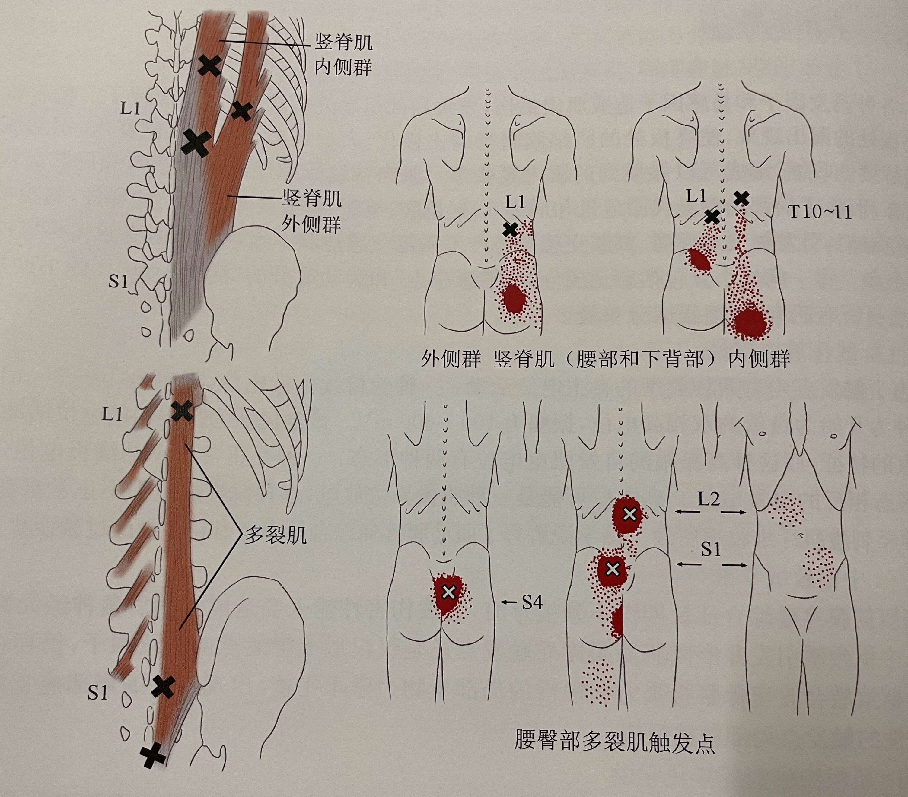 竖脊肌起止点及功能图图片