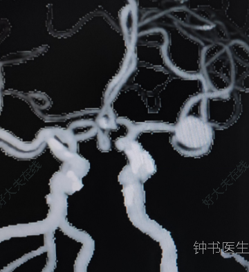 圖文圖片