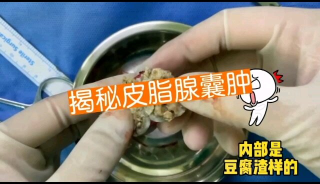 默认图片