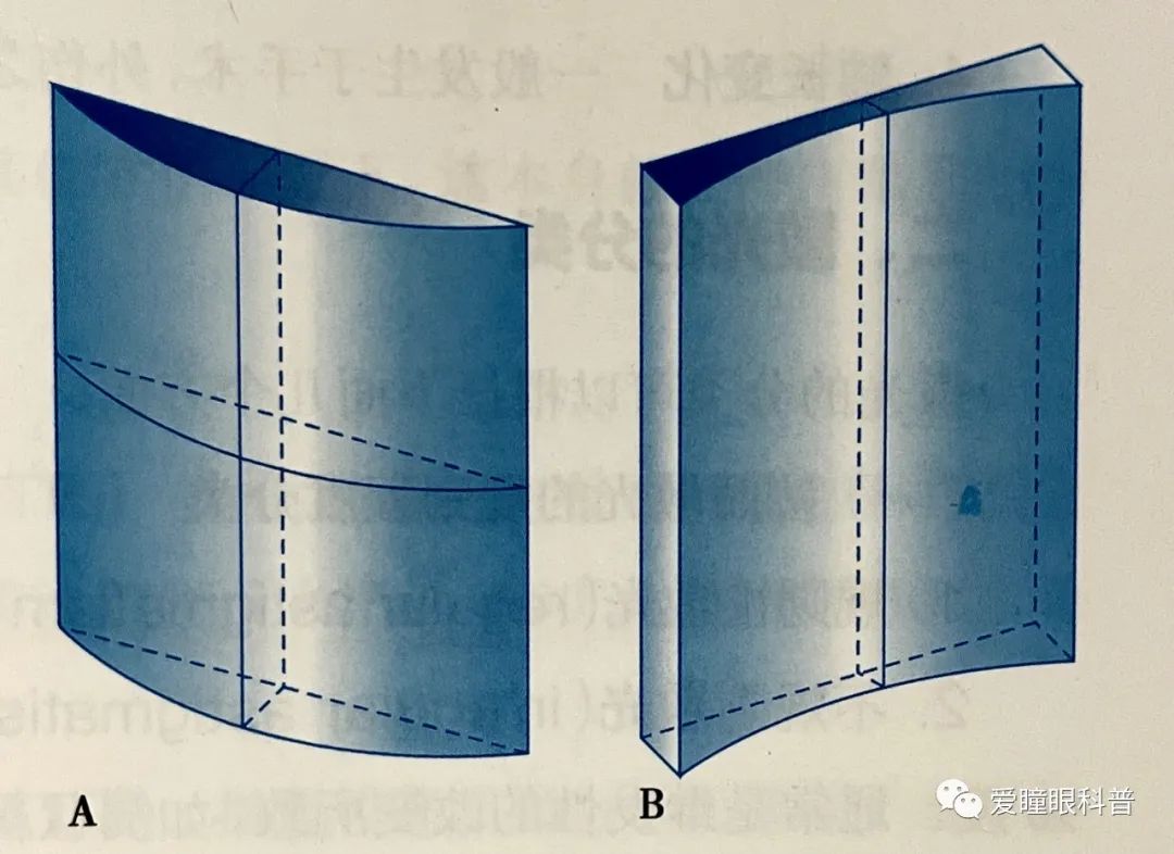 什麼是散光1