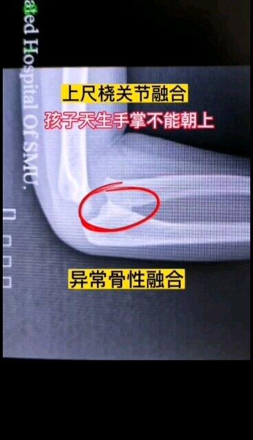 視頻封面
