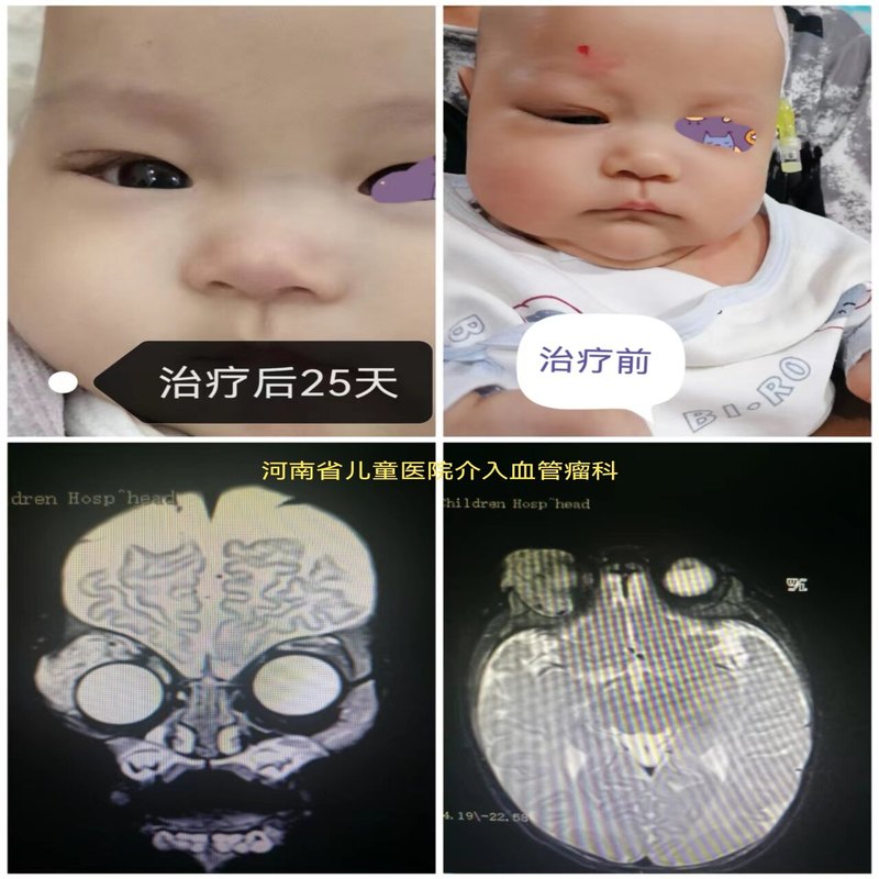 圖文圖片