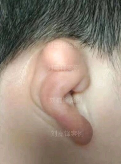 圖文圖片
