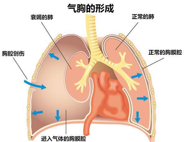 圖文圖片