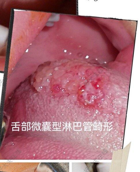 圖文圖片