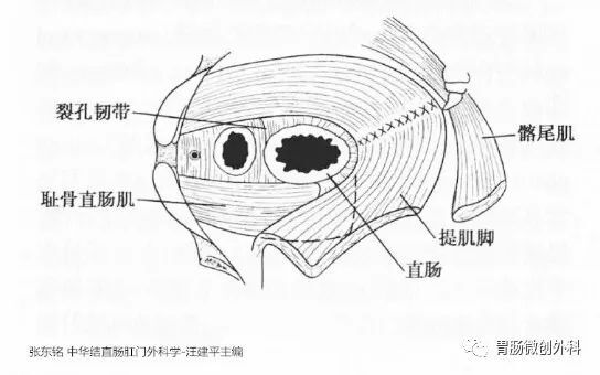 至直肠-肛管结合部的索状物,含有弹力纤维和少量胶原纤维及平滑肌纤维