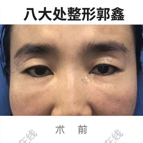 圖文圖片