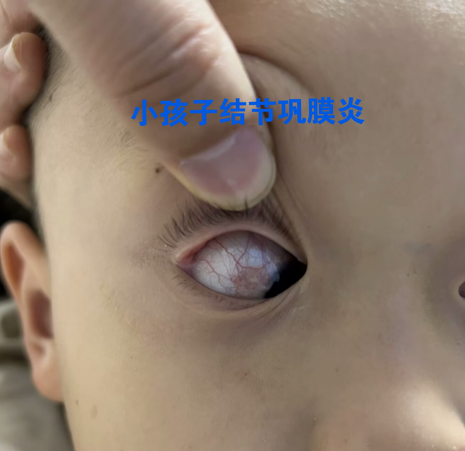 眼科疾病诊断图谱