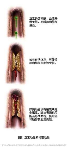 圖文圖片