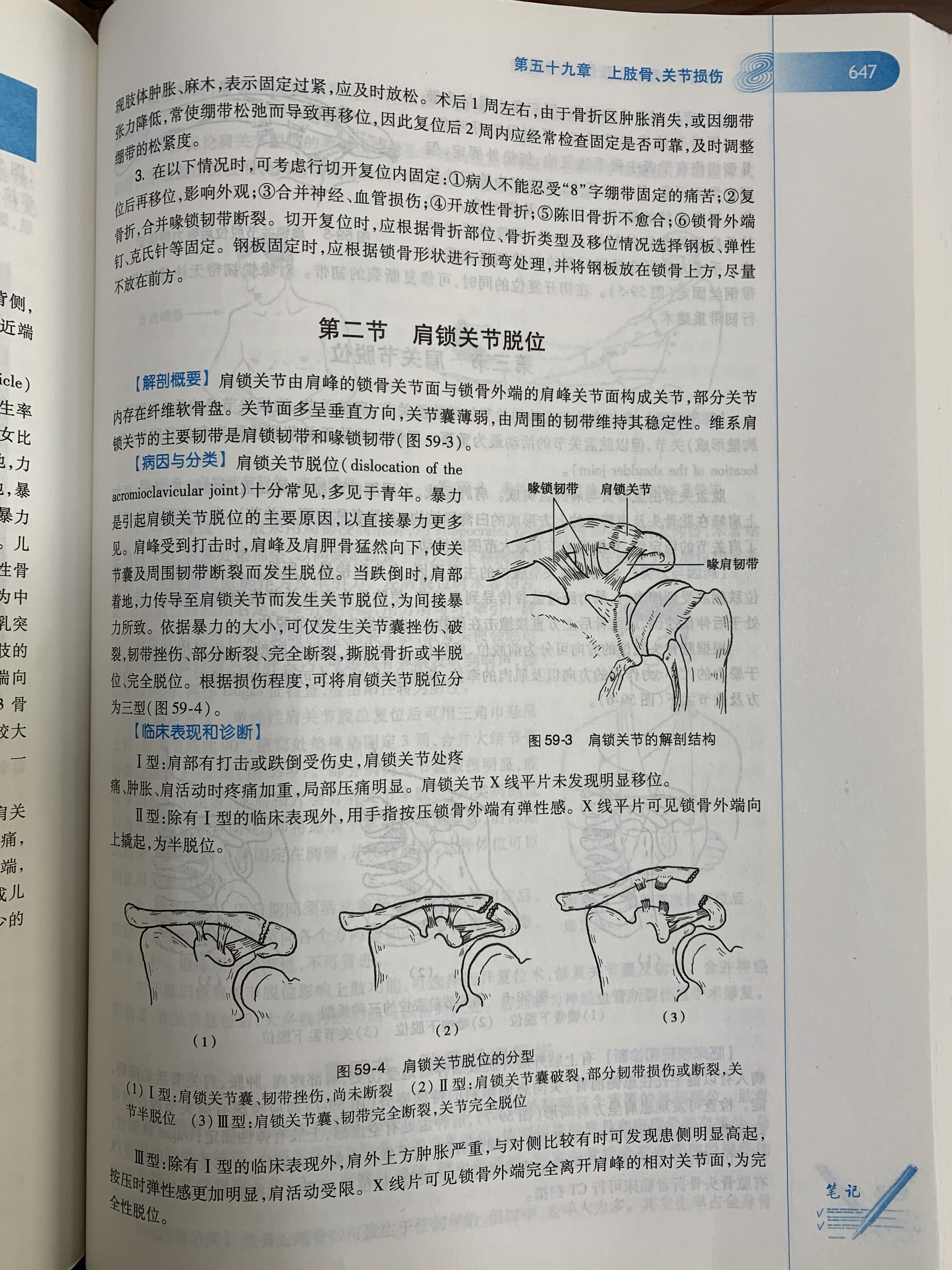 图07. 本科生教材锁骨骨折2.jpg