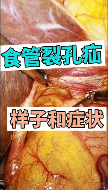 視頻封面