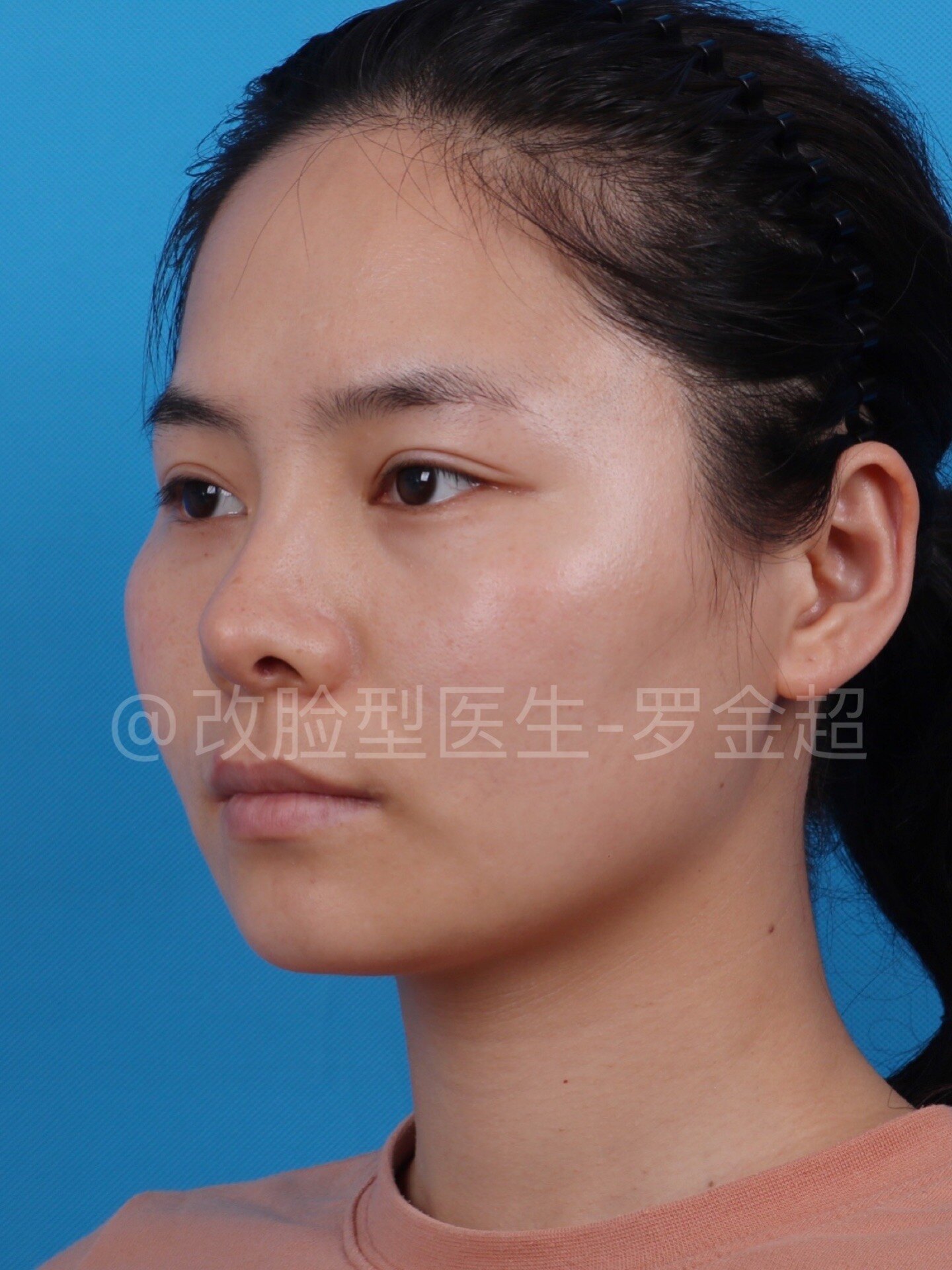 改脸型|颧骨突出、颧弓外扩、下颌骨宽，脸宽？瘦脸修容方法揭秘