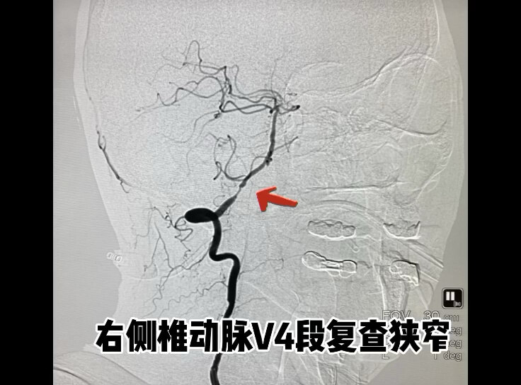 默认图片