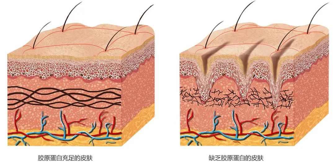 皮肤松弛_介绍_就诊指导 - 好大夫在线