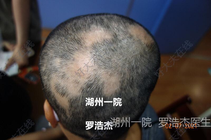 圖文圖片